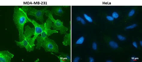 Anti-PD-L1 antibody (GTX104763) | GeneTex