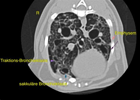 Traction bronchiectasis – VetRad