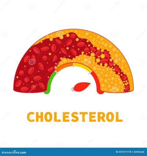 Cholesterol Level Meter Gauge with Blood Vessel Diagram Stock Vector - Illustration of normal ...