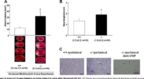 Figure 2 from ADAMTS13 gene deletion aggravates ischemic brain damage: a possible ...