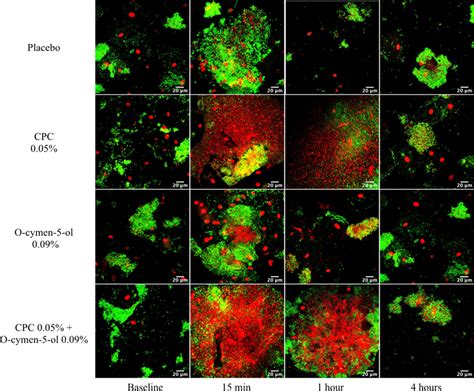 Representative micrographs of bacterial viability at baseline and ...