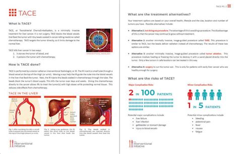 Can decision aids prevent lawsuits in interventional radiology?