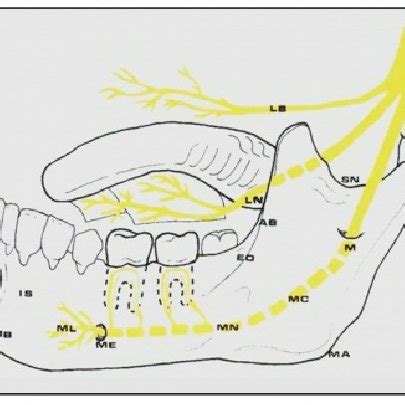 (PDF) Traumatic Injury of the Inferior Alveolar Nerve after Dental ...