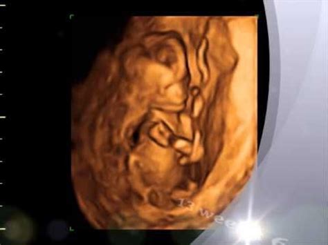 13 week 3d ultrasound