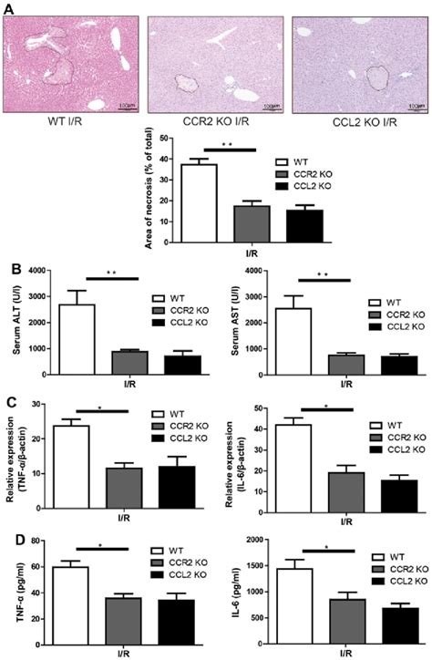 Knockout of CCR2 or CCL2 alleviates liver I/R injury. (A) Three groups... | Download Scientific ...