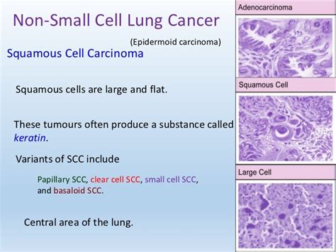 Lung cancer (Animated)