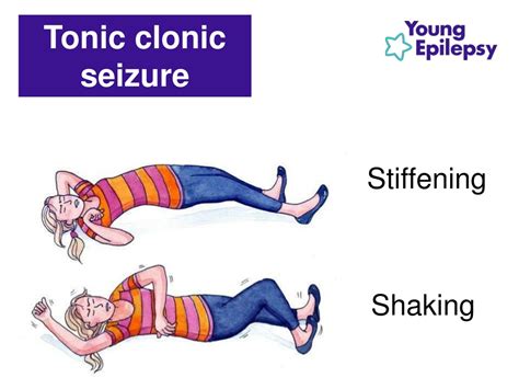 PPT - KS2 Epilepsy awareness & first aid lesson PowerPoint Presentation - ID:19066