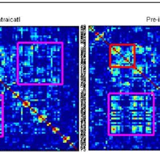 ECoG presenting off-diagonal "hotspots": On the left, an example of a... | Download Scientific ...