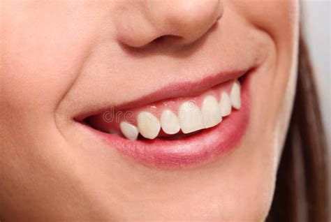 Beautiful smile with teeth stock photo. Image of medical - 29129480