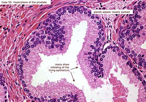 glandular epithelium cells | Cell