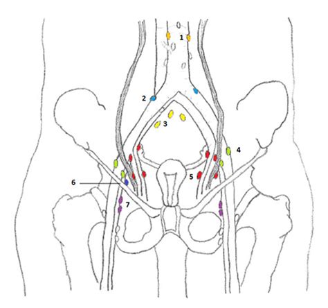 Lymph Nodes of Female Pelvis | SEER Training