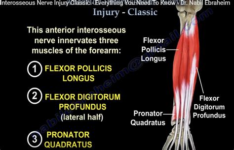 Anterior Interosseous Nerve Palsy — OrthopaedicPrinciples.com