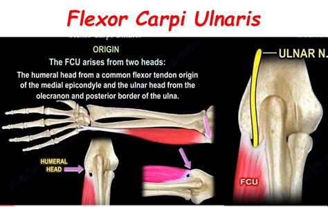 Anatomy of Flexor Carpi Ulnaris — OrthopaedicPrinciples.com