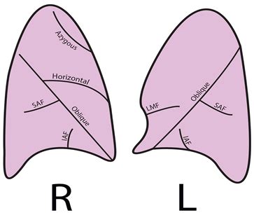 Variations in the Human Pulmonary Fissures and Lobes: A Cadaveric Study