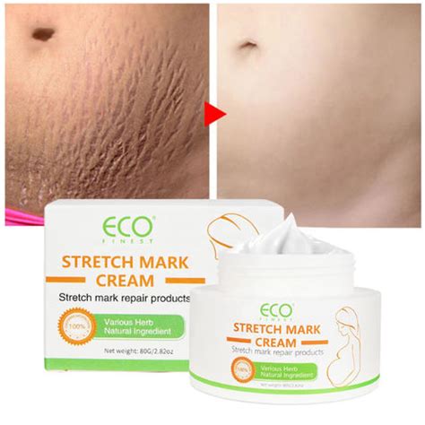 Buy Wholesale China Private Label Best Natural Stretch Mark Cream For Pregnancy & Scar Removal ...