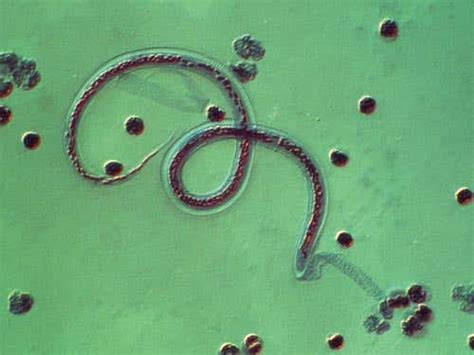 The enemy within: 10 human parasites | New Scientist