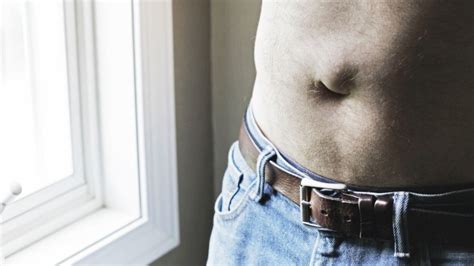 Hernia de ombligo en Adultos: ¿Hay que operar?