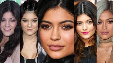 Kylie Jenner’s Face Transformation In Photos: See Her New Face That ...