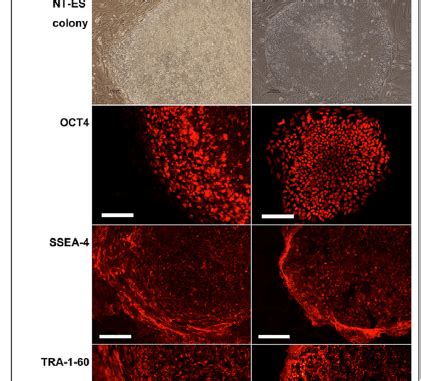 Adult human therapeutic cloning of embryonic stem cells by SCNT - The Niche