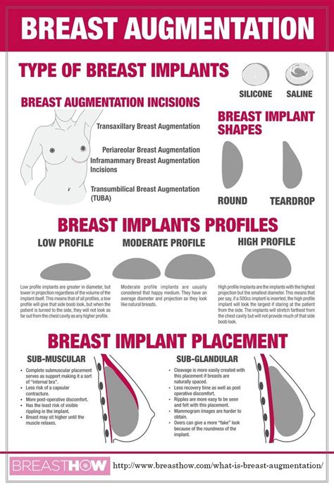 breast implants under the muscle recovery - belancer-mezquita