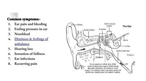 Ear baro