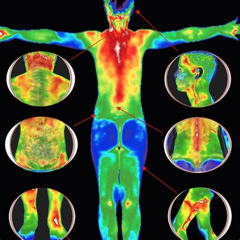 Infrared thermography (IRT), thermal imaging, and thermal video are examples of infrared imaging ...