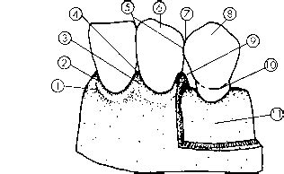 Dental Embrasure Types - Dental Anatomy - Mitch Medical