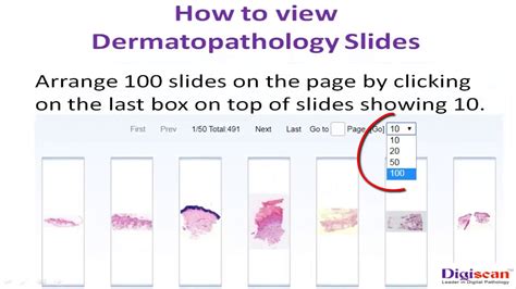 How to View Dermatopathology Slides Set - YouTube