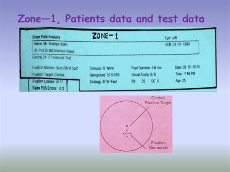 Visual field analysis--interpretation