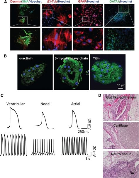 Alpha-Smooth Muscle Actin Antibody (MA1-06110)