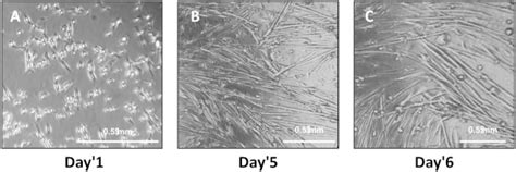 Isolation and Differentiation of Primary Myoblasts from Mouse Skeletal ...