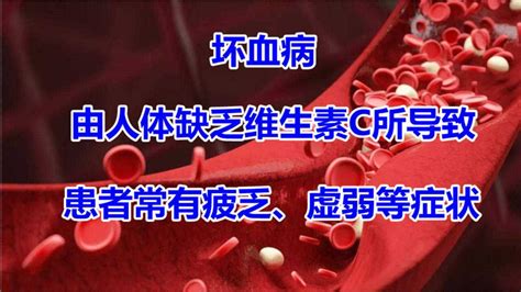 坏血病，由人体缺乏维生素c所导致，患者常有疲乏、虚弱等症状_高清1080P在线观看平台_腾讯视频