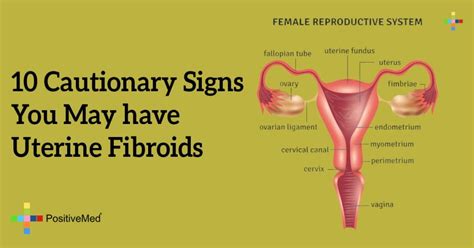 10 Cautionary Signs You May have Uterine Fibroids