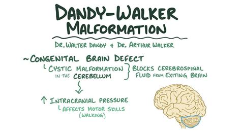 Dandy-Walker malformation: Video, Anatomy & Definition | Osmosis