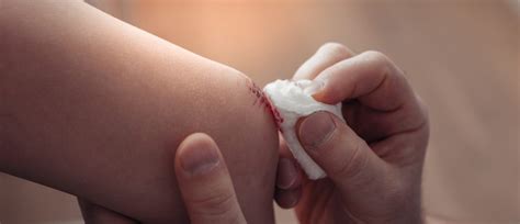 How to Clean a Wound | UPMC HealthBeat