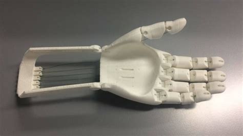 Bringing 3D-Printed Prosthetic Hands to Third-World Countries - Physician's Weekly