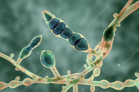 Microsporum audouinii fungus, illustration - Stock Image - F036/7225 - Science Photo Library