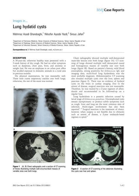 (PDF) Lung hydatid cysts