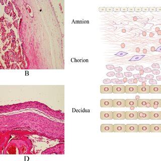 Histopathology of the progression of acute histological... | Download Scientific Diagram