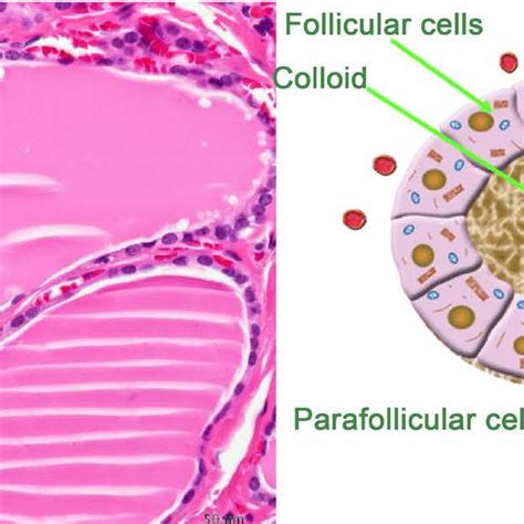 Parafollicular Cell Of Thyroid