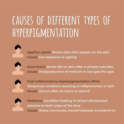 Hyperpigmentation unravelled what causes it and how should you treat it – Artofit