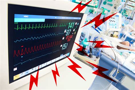 Fatiga de alarmas en anestesia: cómo enfrentar sus desafíos - Anestesialatam