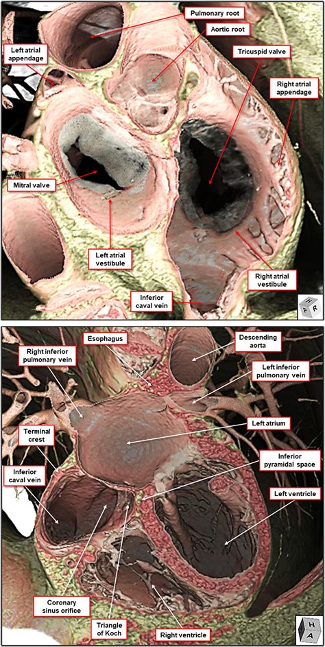 What is the real cardiac anatomy? - Mori - 2019 - Clinical Anatomy ...