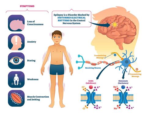 Why epilepsy affects children under five - Business Daily