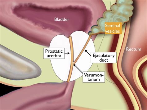 The Radiology Assistant : Prostate Anatomy