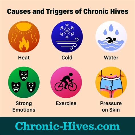 What Are Causes and Triggers of Chronic Hives?