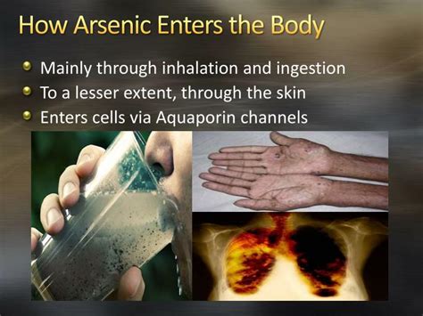 PPT - Arsenic Poisoning PowerPoint Presentation - ID:2195570