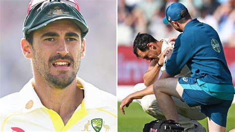 Mitchell Starc injury exposes grim Ashes truth for Australia - Yahoo Sport