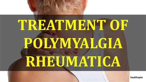 TREATMENT OF POLYMYALGIA RHEUMATICA - YouTube