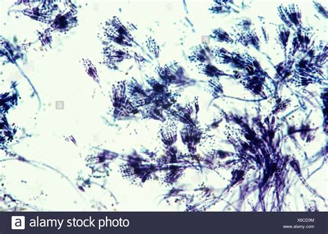 Penicillium Stock Photos & Penicillium Stock Images - Alamy